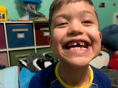 Cody missing two teeth
